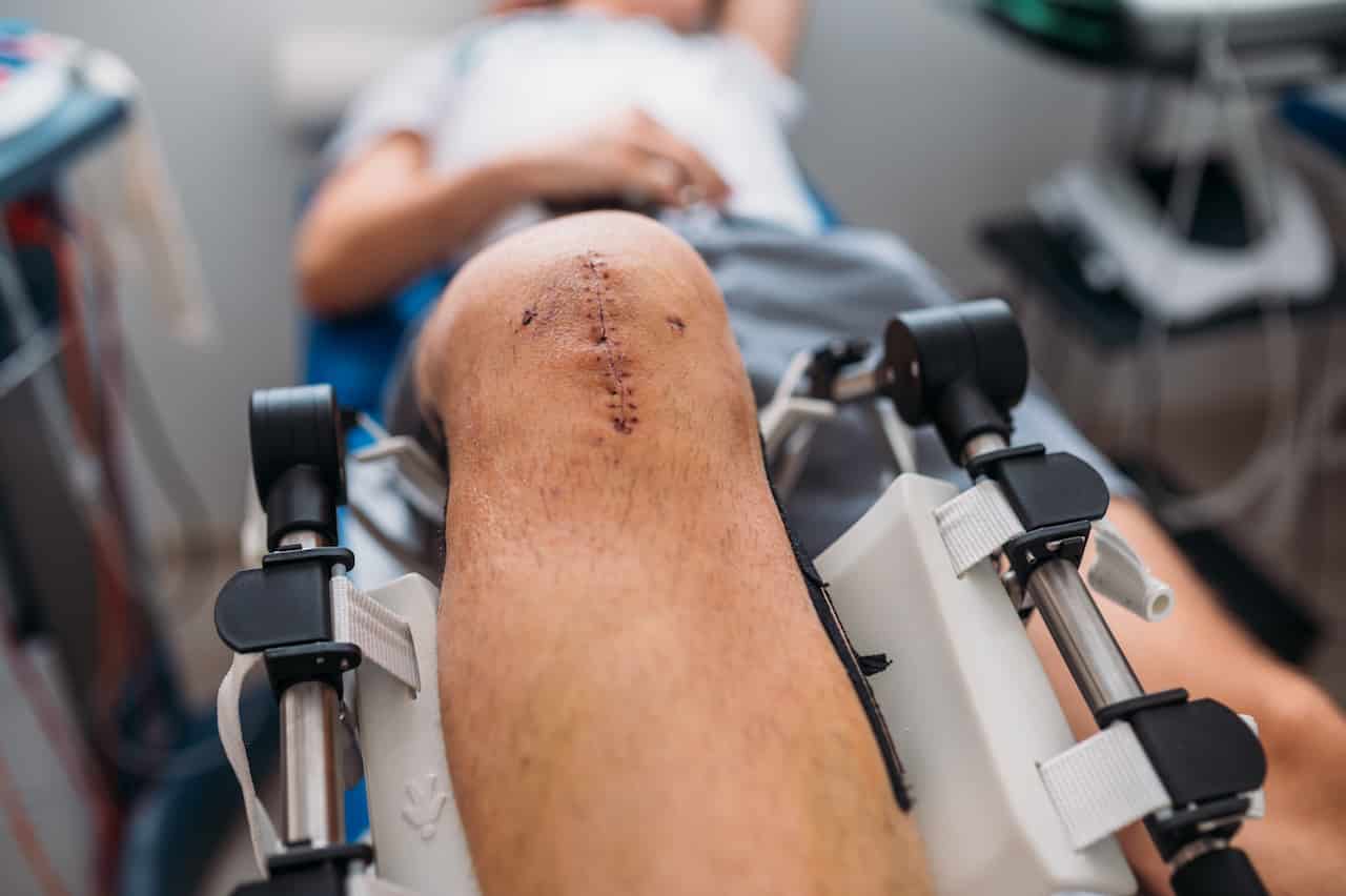 cpm artromot za oporavak kod operacije ligamenata kolena